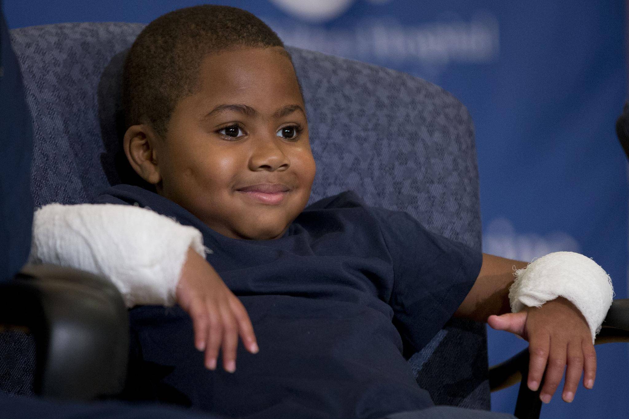 Eight-year-old boy becomes youngest double-hand transplant recipient - The  Globe and Mail
